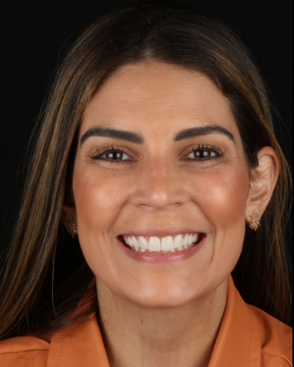 Sorriso natural após odontologia estética
